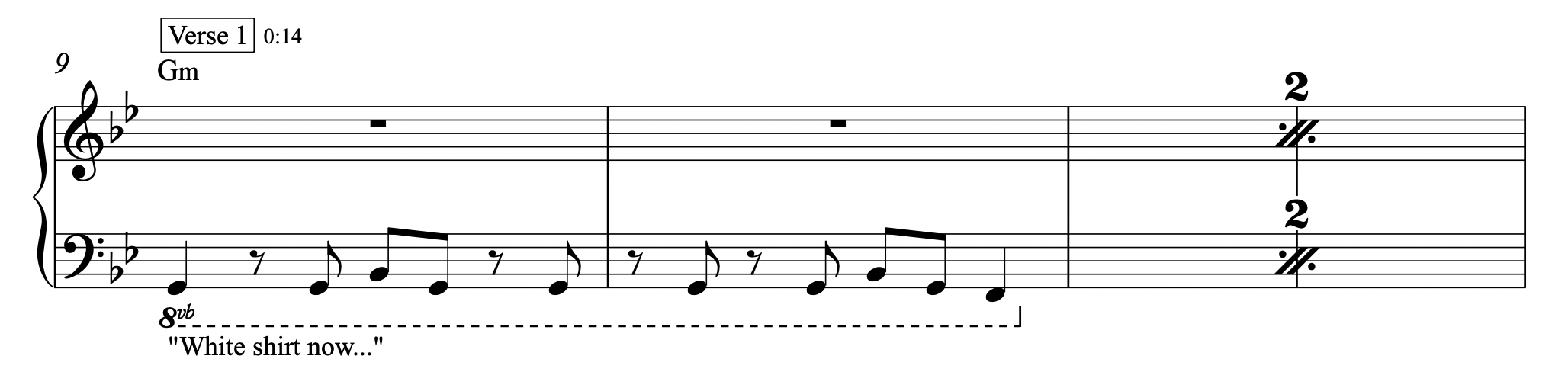 bad guy - Billie Eilish - Keyboard Sheet Music